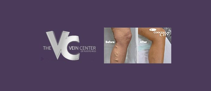 Vein Center listing image